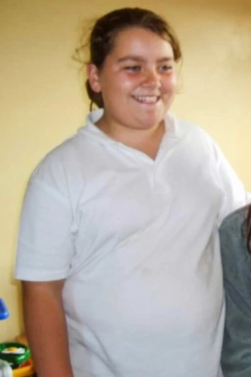 Accidental weight loss: a girl dropped 57 kg while walking a dog