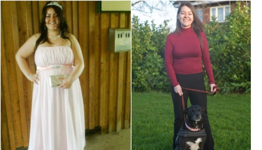 Accidental weight loss: a girl dropped 57 kg while walking a dog