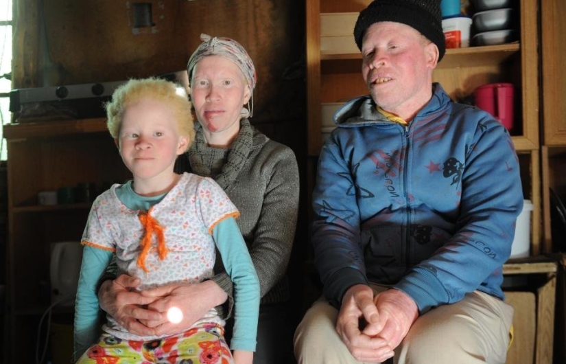 African albinos do not hide their fears