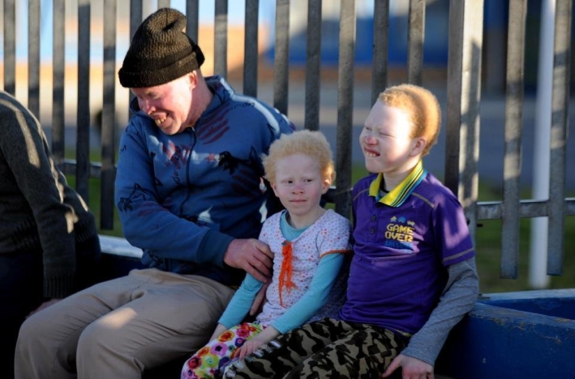 African albinos do not hide their fears