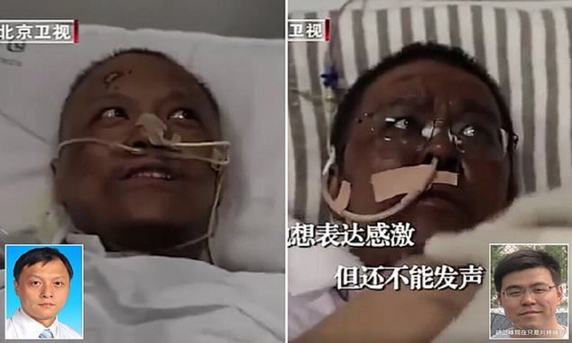 After treatment for coronavirus, doctors from Wuhan became dark-skinned After treatment for coronavirus, doctors from Wuhan became dark-skinned