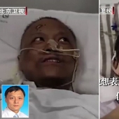 After treatment for coronavirus, doctors from Wuhan became dark-skinned