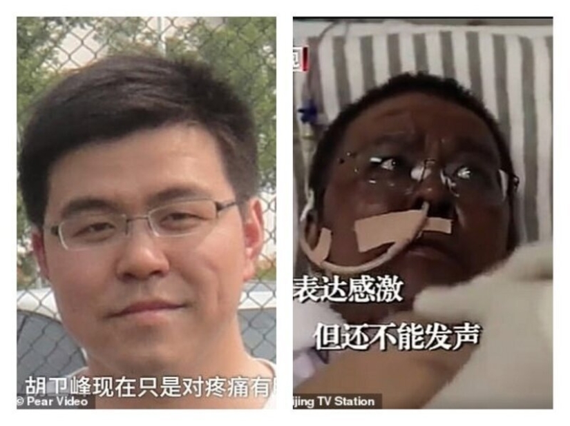 After treatment for coronavirus, doctors from Wuhan became dark-skinned After treatment for coronavirus, doctors from Wuhan became dark-skinned