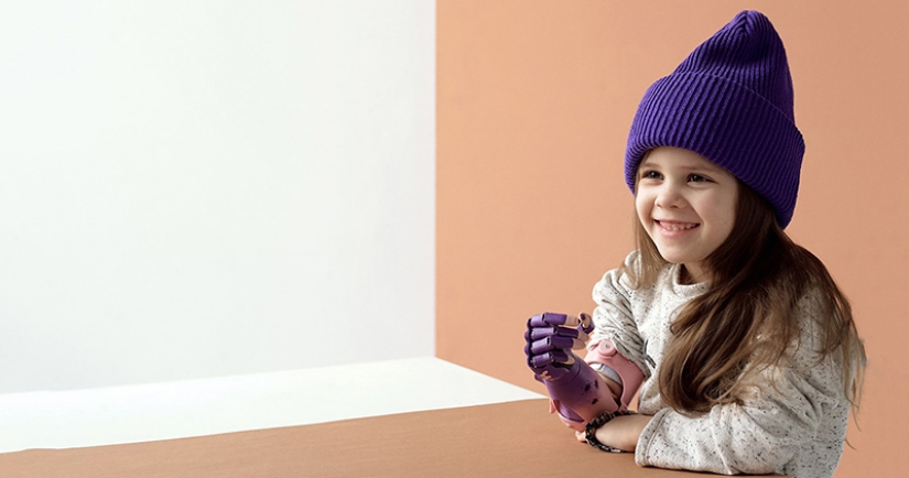 Alice in Wonderland: a little resident of Chelyabinsk was given a cyber hand in Skolkovo