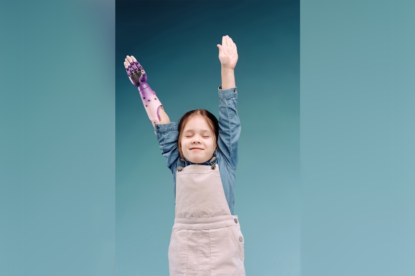 Alice in Wonderland: a little resident of Chelyabinsk was given a cyber hand in Skolkovo