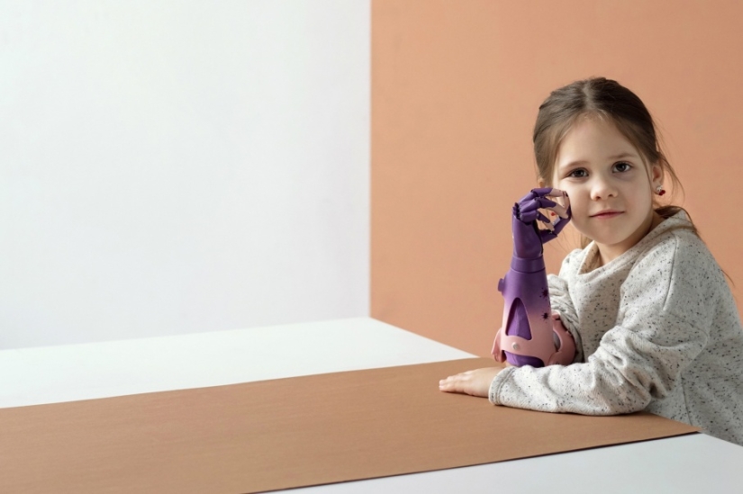 Alice in Wonderland: a little resident of Chelyabinsk was given a cyber hand in Skolkovo