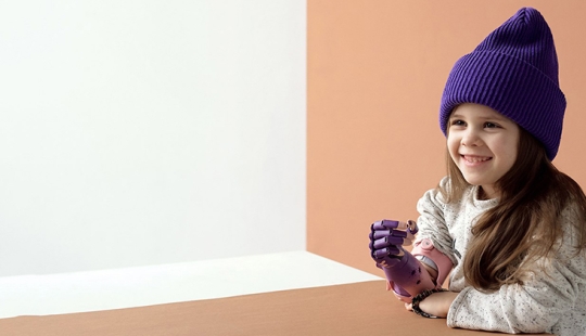 Alice in Wonderland: a little resident of Chelyabinsk was given a cyber hand in Skolkovo