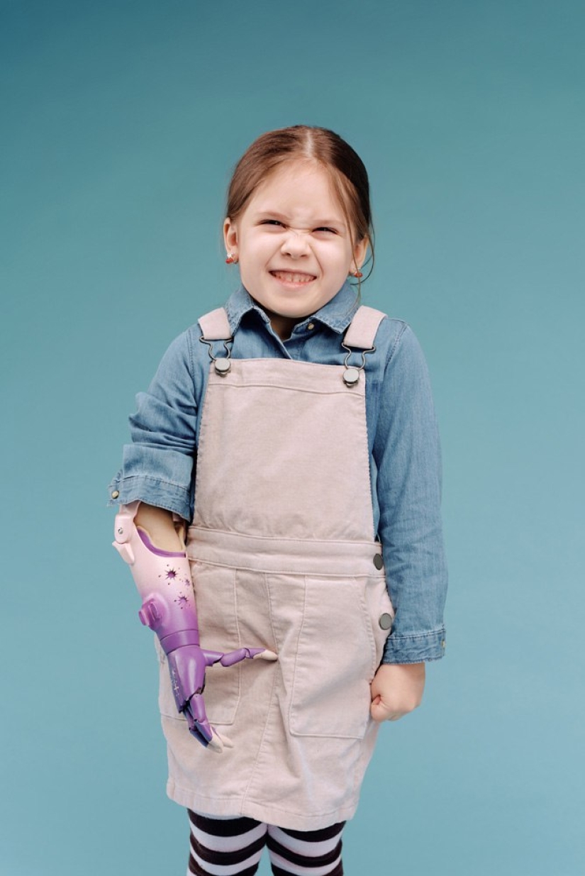 Alicia en el país de las Maravillas: un pequeño residente de Chelyabinsk recibió una mano cibernética en Skolkovo Alicia en el país de las Maravillas: un pequeño residente de Chelyabinsk recibió una mano cibernética en Skolkovo