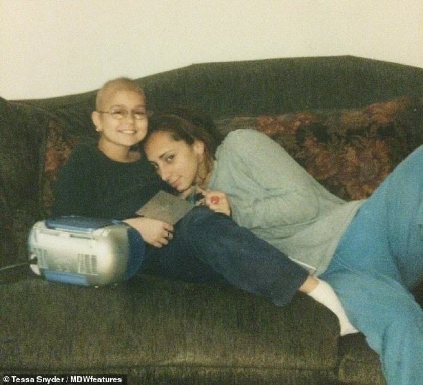 "Amputation is better already": a girl lost her leg at the age of 11, became a model and now inspires others