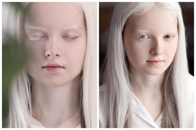 An albino girl from Chechnya struck with her unique appearance An albino girl from Chechnya struck with her unique appearance