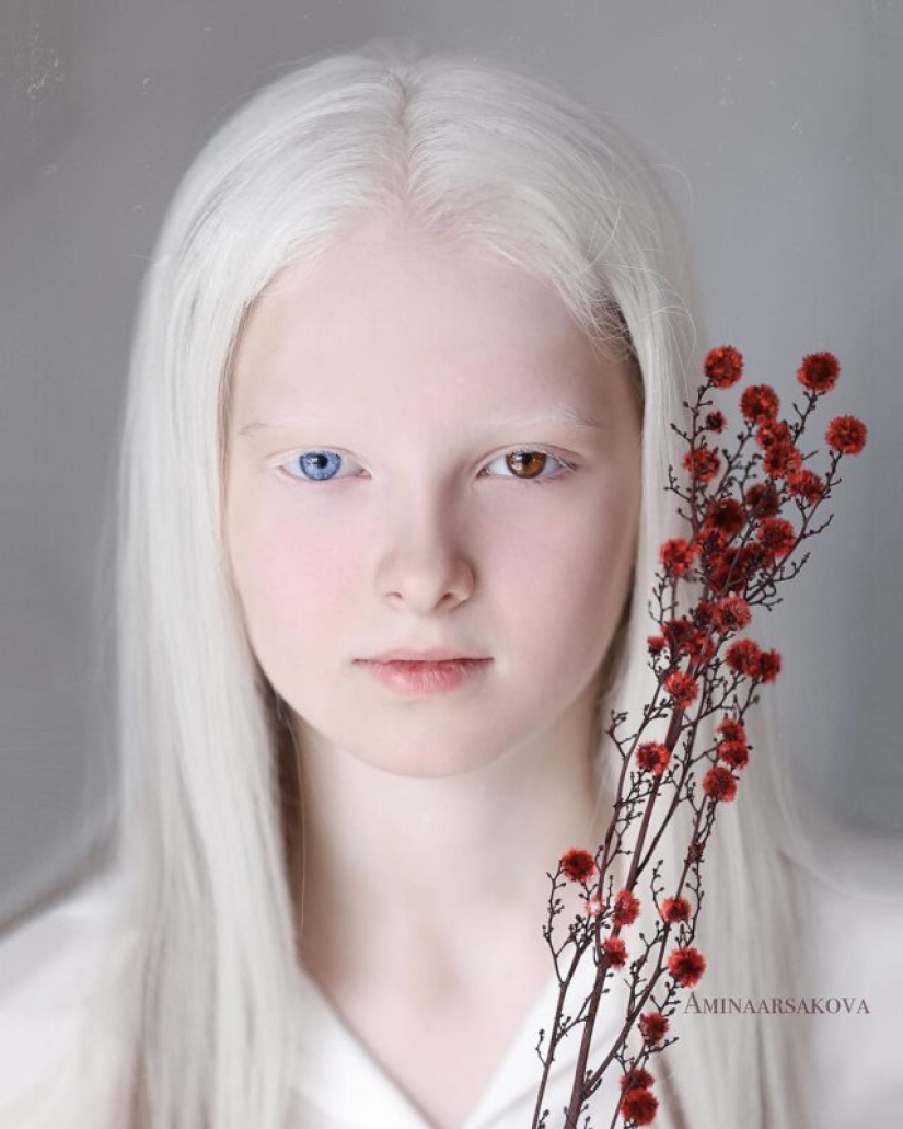 An albino girl from Chechnya struck with her unique appearance An albino girl from Chechnya struck with her unique appearance