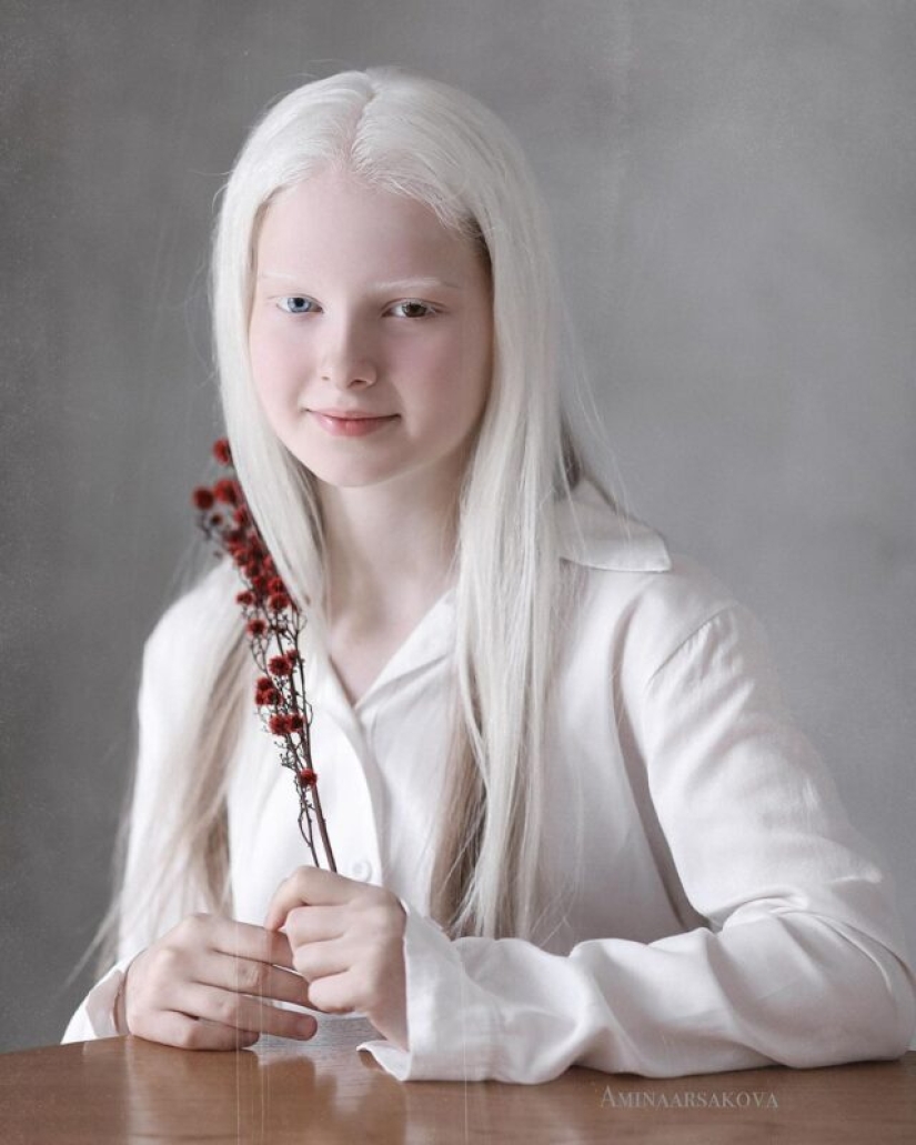 An albino girl from Chechnya struck with her unique appearance An albino girl from Chechnya struck with her unique appearance