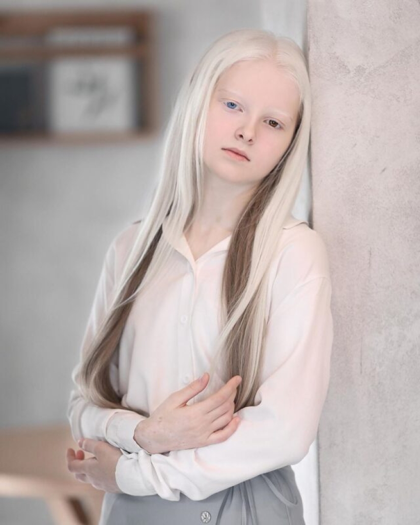 An albino girl from Chechnya struck with her unique appearance An albino girl from Chechnya struck with her unique appearance