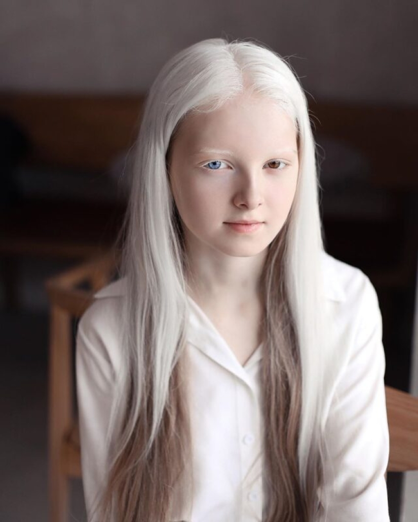 An albino girl from Chechnya struck with her unique appearance An albino girl from Chechnya struck with her unique appearance