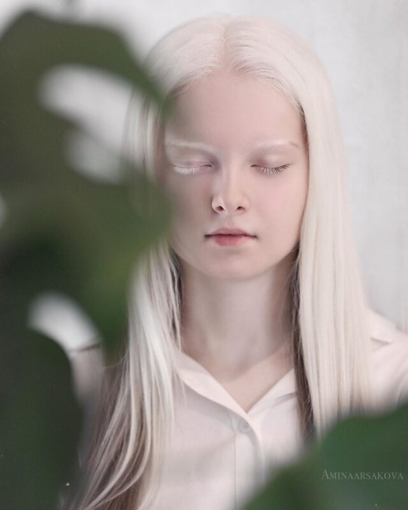An albino girl from Chechnya struck with her unique appearance An albino girl from Chechnya struck with her unique appearance