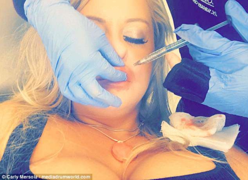 An American woman spent 50 thousand dollars to become like her idol — the girlfriend of Roger rabbit