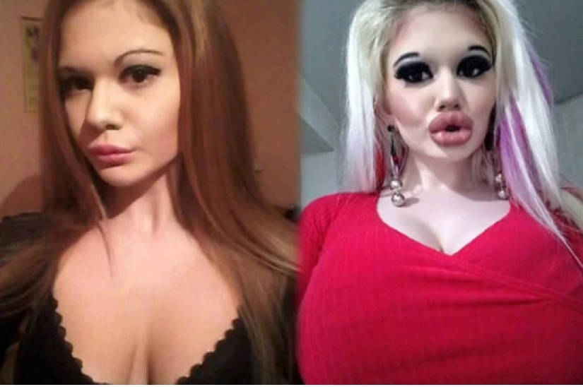 Ansia de belleza: estudiante búlgara agranda sus labios y no puede parar