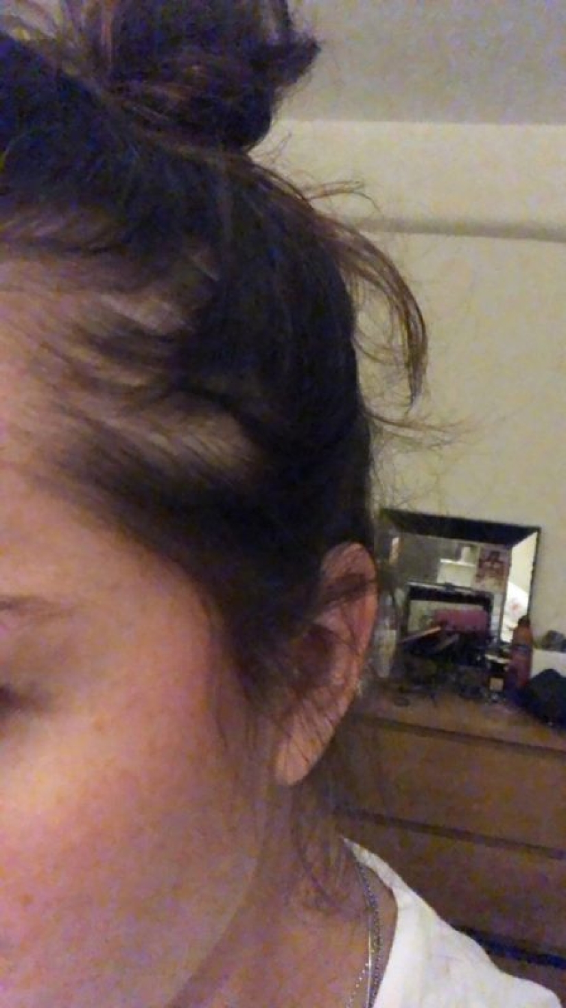 Apartment killer: the girl almost died from mold on the walls of the house