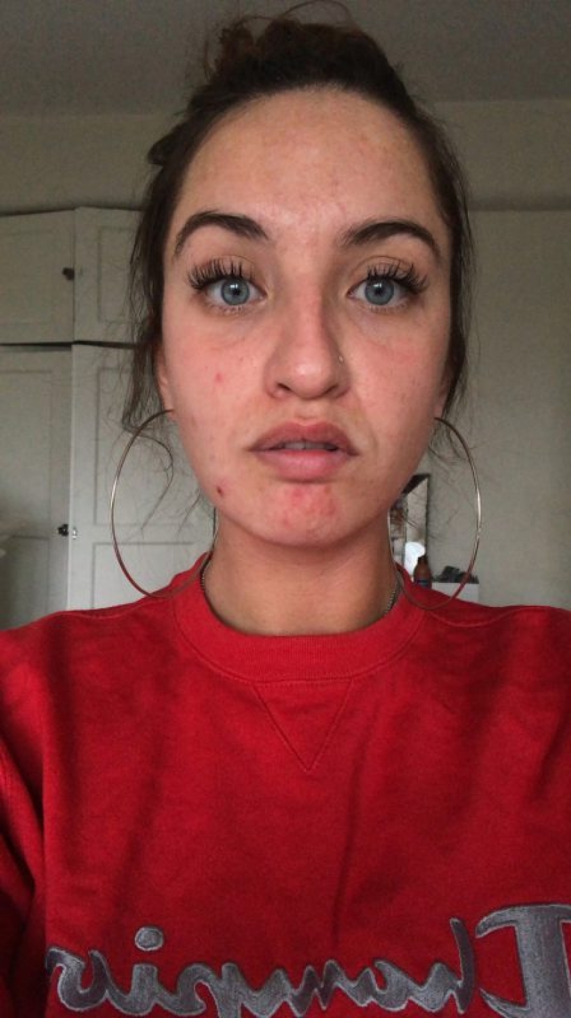 Apartment killer: the girl almost died from mold on the walls of the house