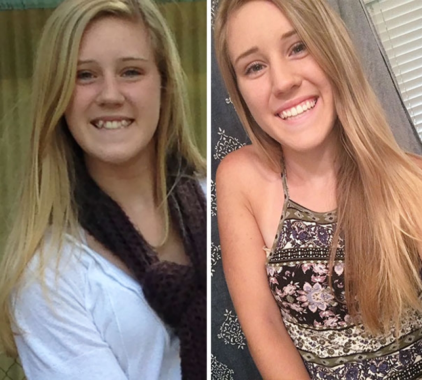 Así es como los frenillos cambian radicalmente una sonrisa y una vida