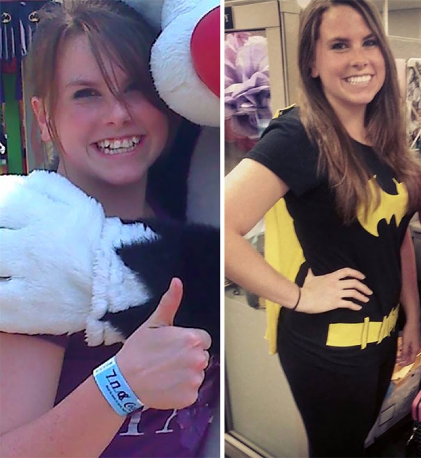 Así es como los frenillos cambian radicalmente una sonrisa y una vida