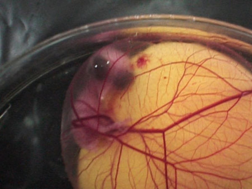 As the egg develops chicken