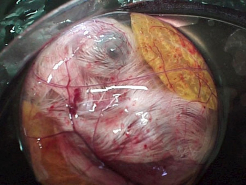 As the egg develops chicken