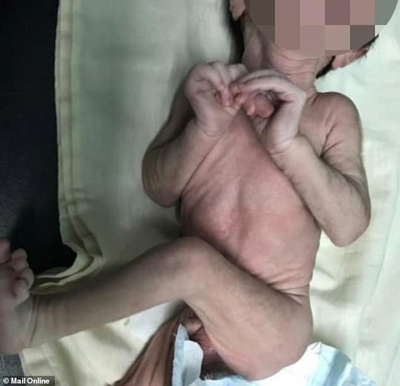 At the price of children's tears: Venezuela pays too much for democracy