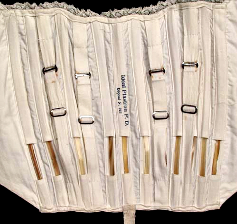 Aumento de senos hace 100 años. ¿Cómo estuvo?