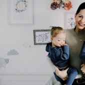 "Babies in a million": a British couple had unique twin girls