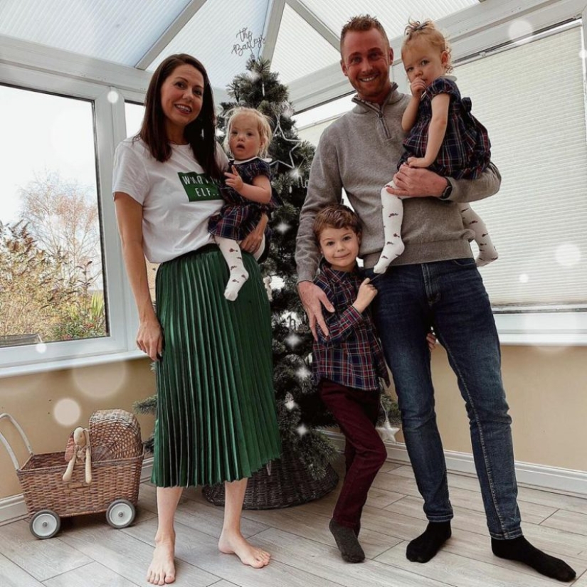 "Babies in a million": a British couple had unique twin girls