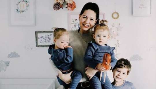 "Babies in a million": a British couple had unique twin girls