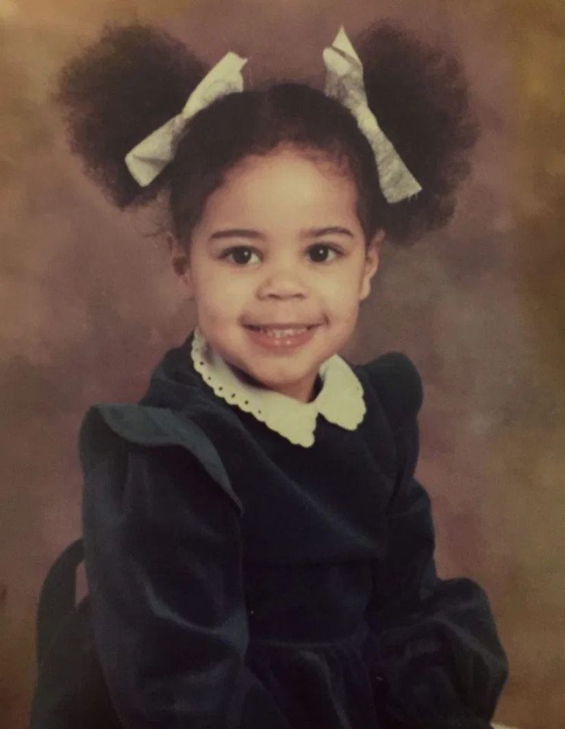 Bald, brave, proud: women who learned to live with alopecia and fell in love with themselves without hair