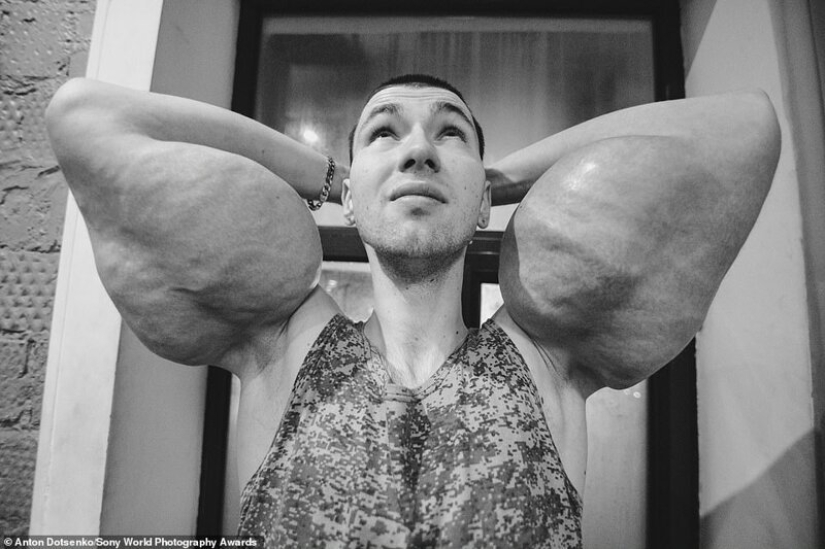 Bazooka hands and other pictures from the Sony World Photography Award 2020 shortlist