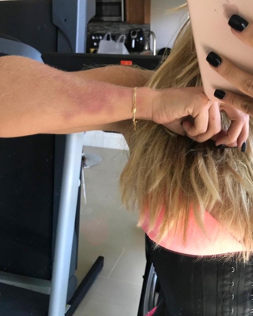 Beaten love: the famous model suffered beatings and humiliation from her boyfriend for two years