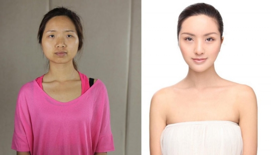 Beauty standards: Chinese women after plastic surgery