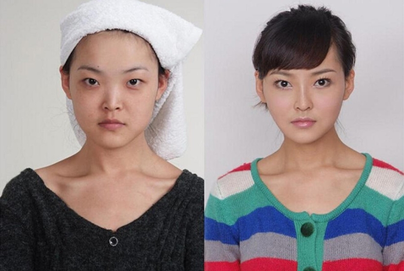 Beauty standards: Chinese women after plastic surgery