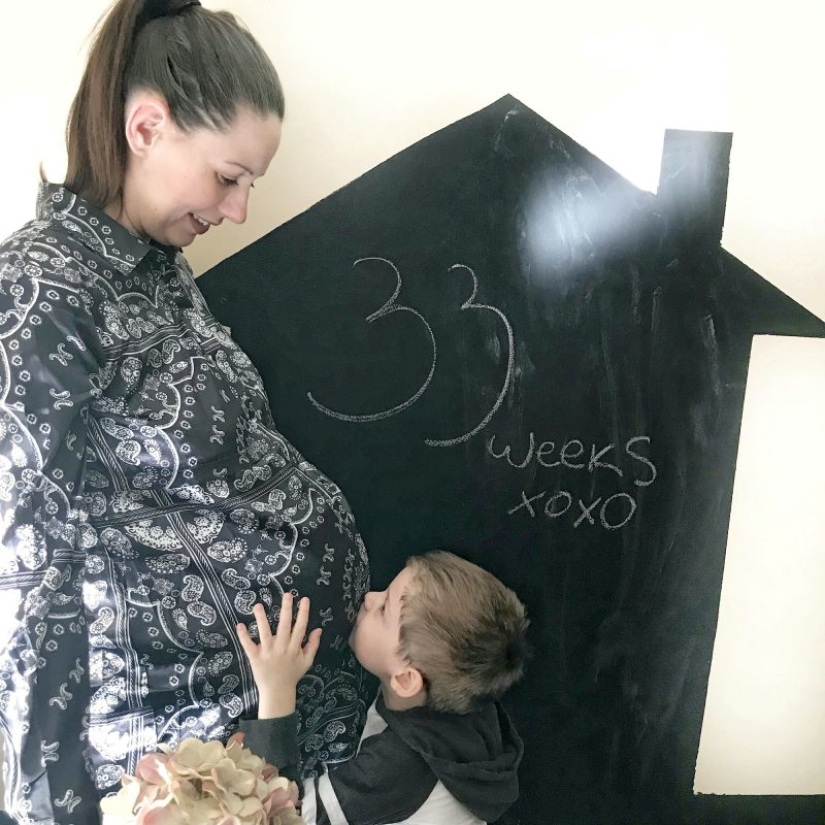 "Bebés en un millón": una pareja británica tenía gemelas únicas