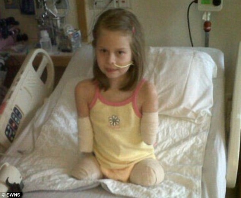 Because of the terrible virus, the girl's limbs were amputated, but she learned to play the piano Because of the terrible virus, the girl's limbs were amputated, but she learned to play the piano