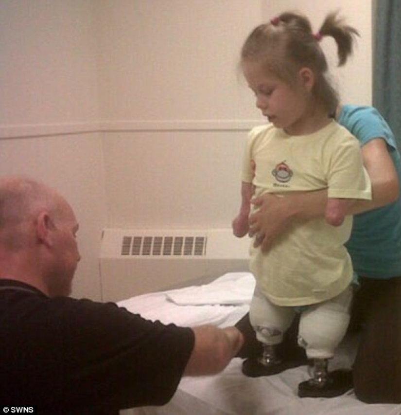 Because of the terrible virus, the girl's limbs were amputated, but she learned to play the piano Because of the terrible virus, the girl's limbs were amputated, but she learned to play the piano