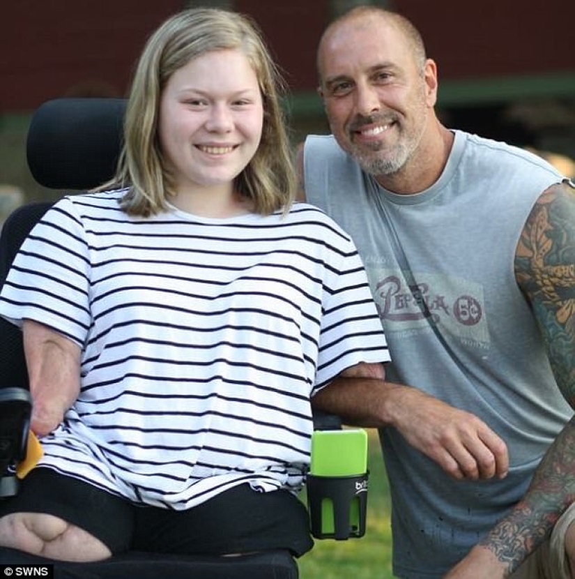 Because of the terrible virus, the girl's limbs were amputated, but she learned to play the piano Because of the terrible virus, the girl's limbs were amputated, but she learned to play the piano