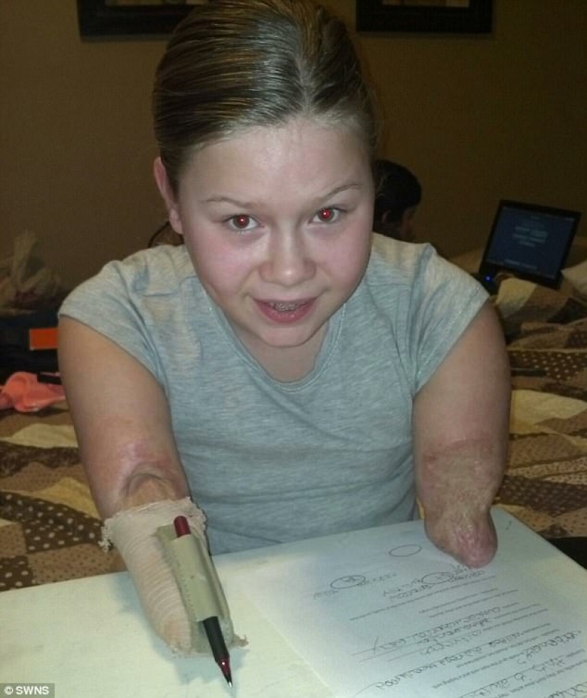 Because of the terrible virus, the girl's limbs were amputated, but she learned to play the piano Because of the terrible virus, the girl's limbs were amputated, but she learned to play the piano