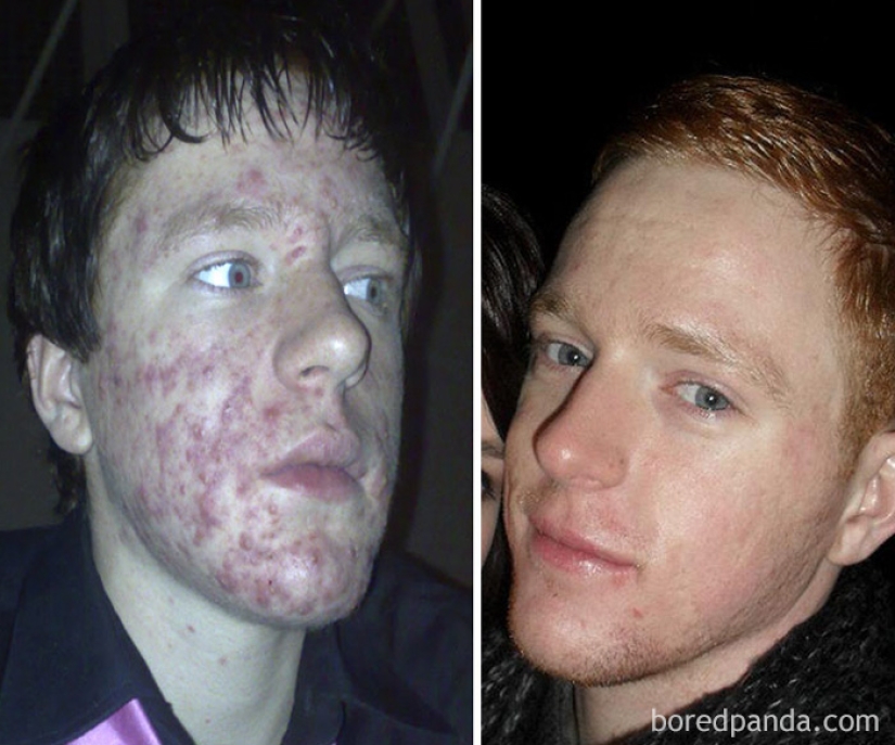 Before and after: how the former "ugly ducklings" are transformed