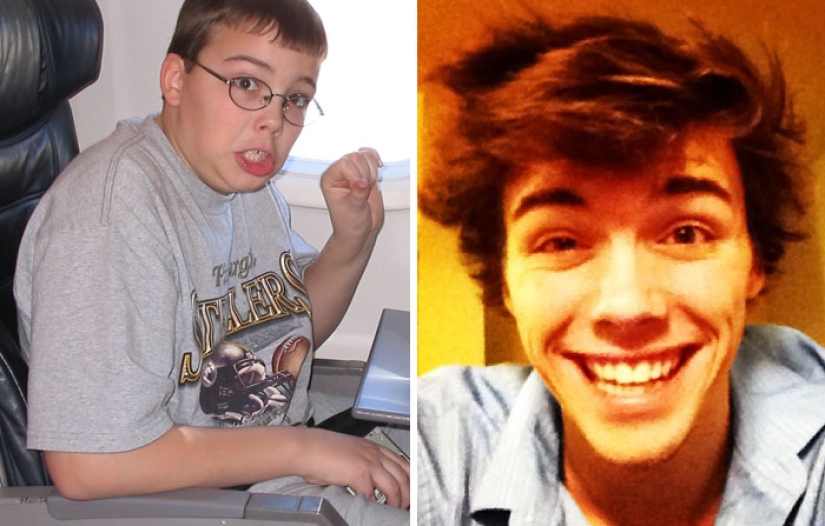 Before and after: how the former "ugly ducklings" are transformed