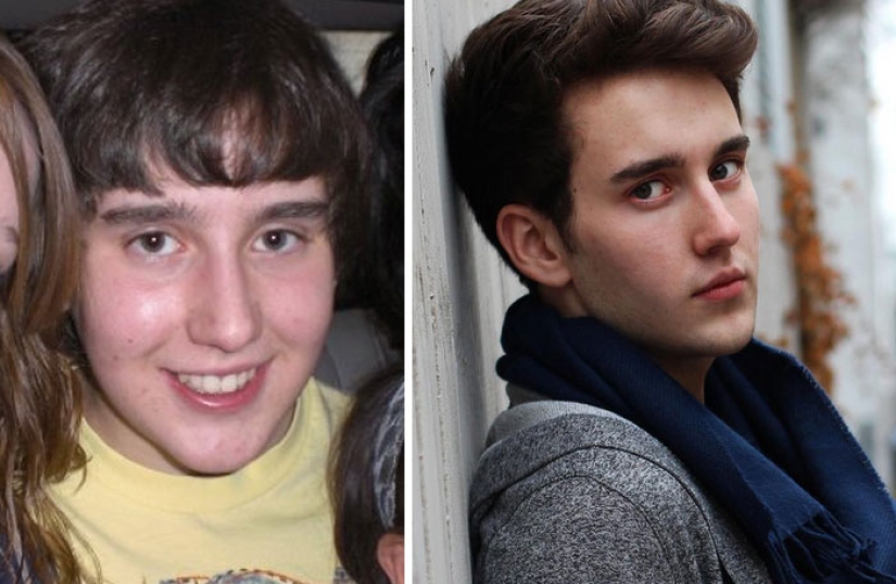 Before and after: how the former "ugly ducklings" are transformed