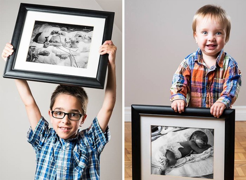 Before and after: strong photos of children who were born prematurely Before and after: strong photos of children who were born prematurely