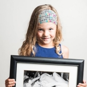 Before and after: strong photos of children who were born prematurely