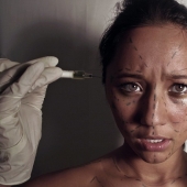 Big breasts — big debts: a single mother is mired in loans because of a passion for plastic surgery