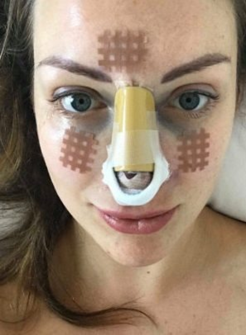 Big breasts — big debts: a single mother is mired in loans because of a passion for plastic surgery