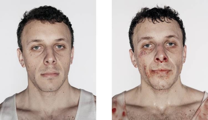 Boxeadores jóvenes: antes y después de la pelea